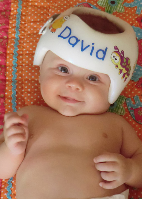 Kleinkind mit Helm für Helmtherapie